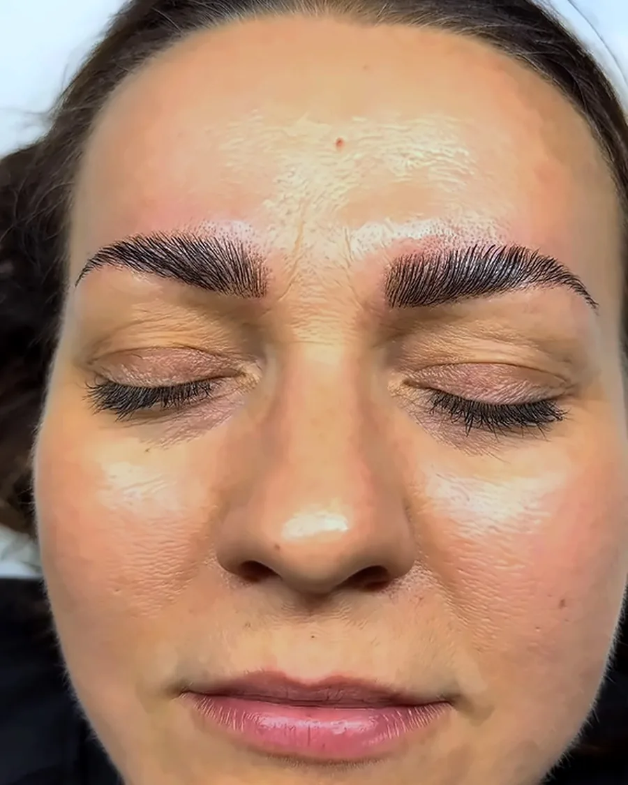 After: Brow lamination