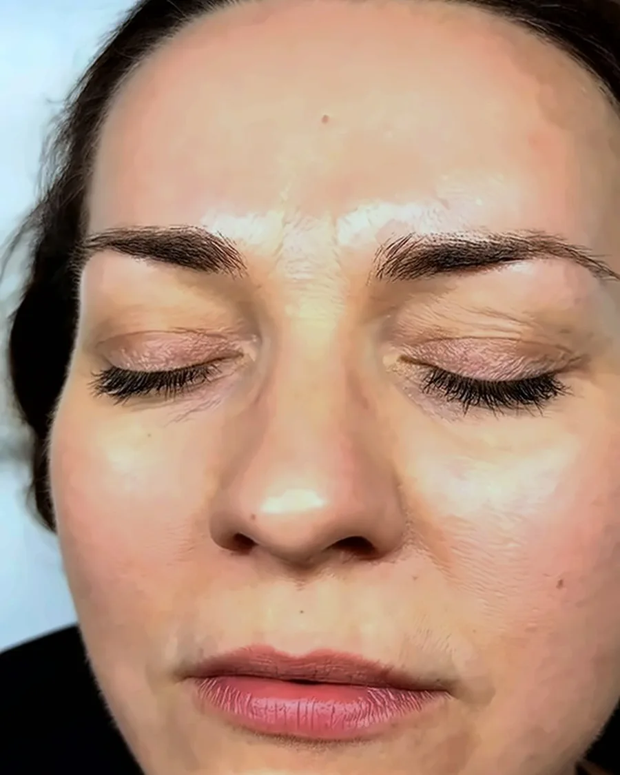 Before: Brow lamination